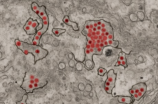 最新：新布尼亚病毒疫情引发国际关注